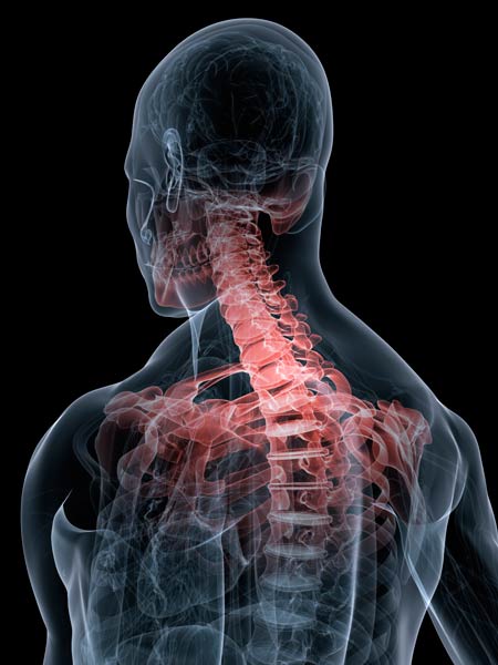 Y-Strap Technique in Cleburne Texas